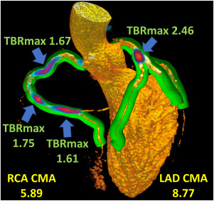 Novel PET Applications and Radiotracers for Imaging Cardiovascular Pathophysiology