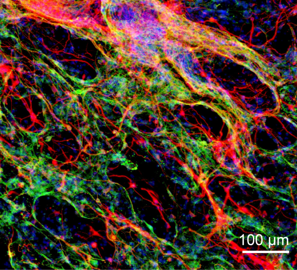 Healing the brain: hydrogels enable neuronal tissue growth