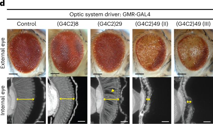 Author Correction: Toxic expanded GGGGCC repeat transcription is mediated by the PAF1 complex in C9orf72-associated FTD