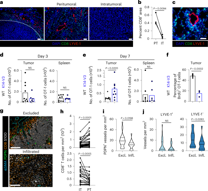 T cell egress via lymphatic vessels is tuned by antigen encounter and limits tumor control