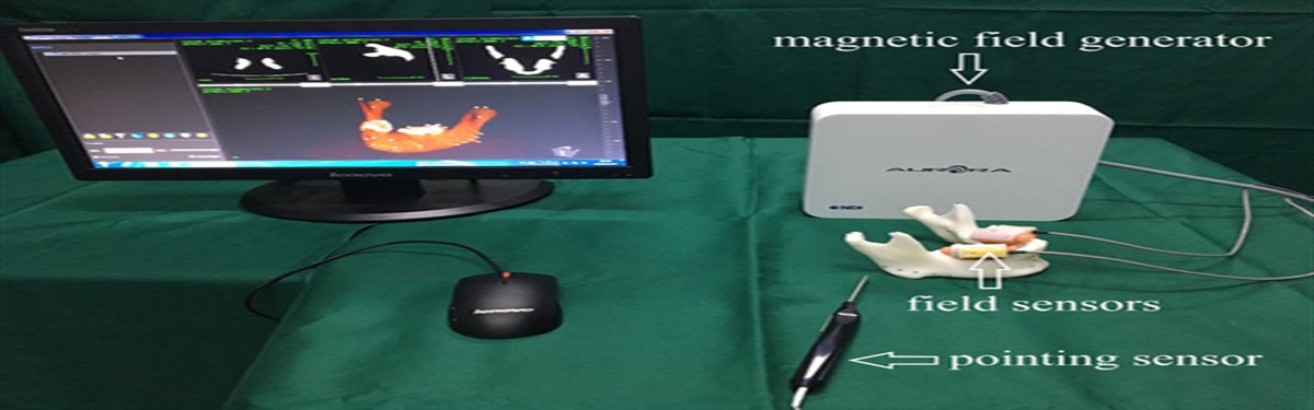 The Feasibility of Electromagnetic Navigation Technique to Achieve Preoperative Plan in Mandibular Angle Osteotomy