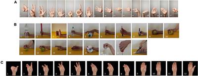 LST-EMG-Net: Long short-term transformer feature fusion network for sEMG gesture recognition