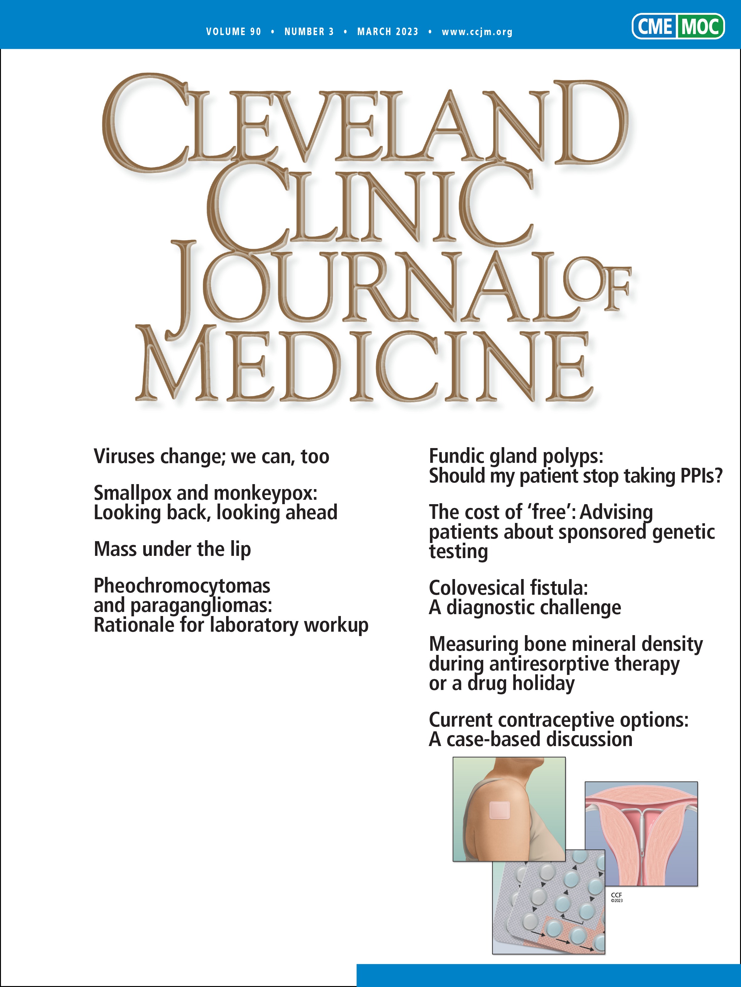 To repeat or not to repeat? Measuring bone mineral density during anti-resorptive therapy or a drug holiday