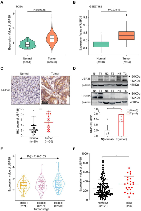 USP35 promotes cell proliferation and chemotherapeutic resistance through stabilizing FUCA1 in colorectal cancer