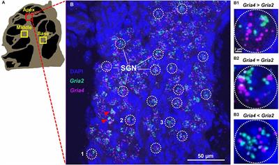 Sex differences in glutamate AMPA receptor subunits mRNA with fast gating kinetics in the mouse cochlea