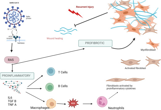 Post-COVID Interstitial Lung Disease—The Tip of the Iceberg