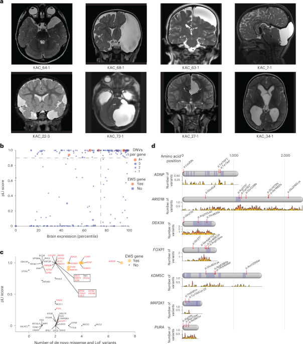 Multiomic analyses implicate a neurodevelopmental program in the pathogenesis of cerebral arachnoid cysts
