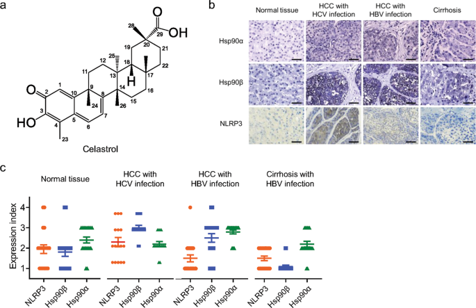 Celastrol attenuates hepatitis C virus translation and inflammatory response in mice by suppressing heat shock protein 90β