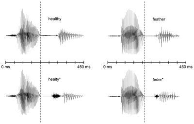 Non-game like training benefits spoken foreign-language processing in children with dyslexia