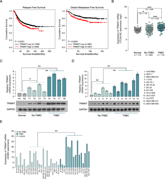 Overexpression of tripartite motif-containing 47 (TRIM47) confers sensitivity to PARP inhibition via ubiquitylation of BRCA1 in triple negative breast cancer cells