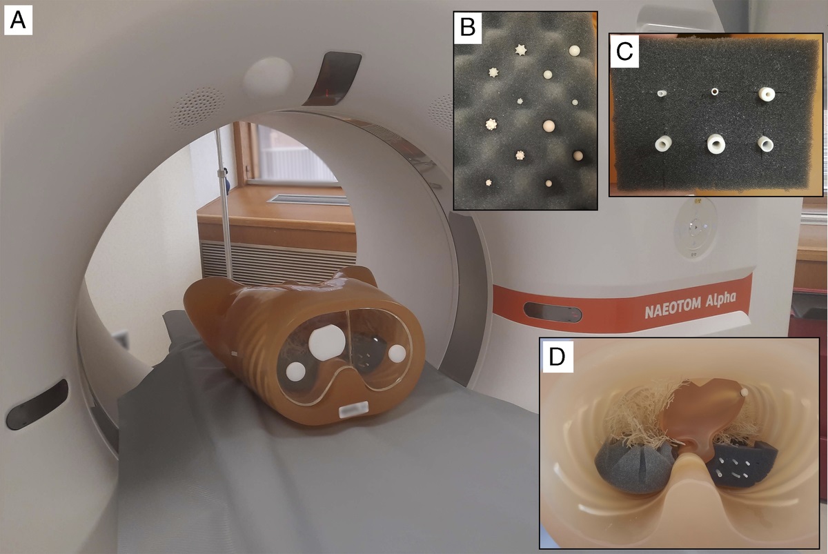 Accuracy of Nodule Volume and Airway Wall Thickness Measurement Using Low-Dose Chest CT on a Photon-Counting Detector CT Scanner