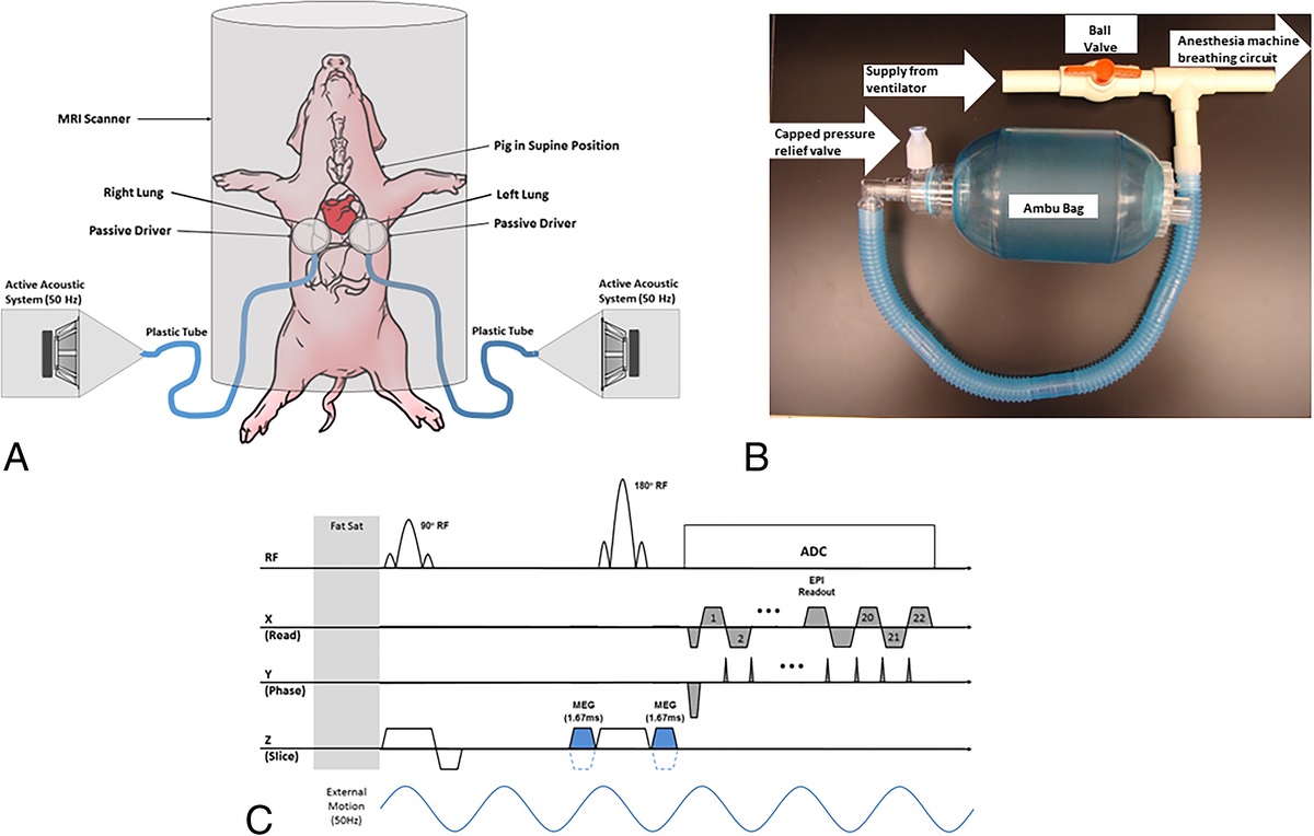 Magnetic Resonance Elastography (MRE) of Bleomycin-Induced Pulmonary Fibrosis in an Animal Model