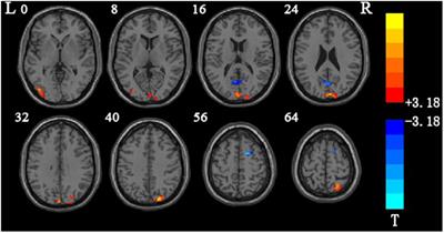Research on brain functions related to visual information processing and body coordination function of pilots based on the low-frequency amplitude method
