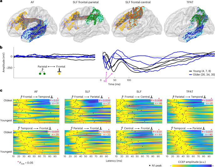 Developmental trajectory of transmission speed in the human brain