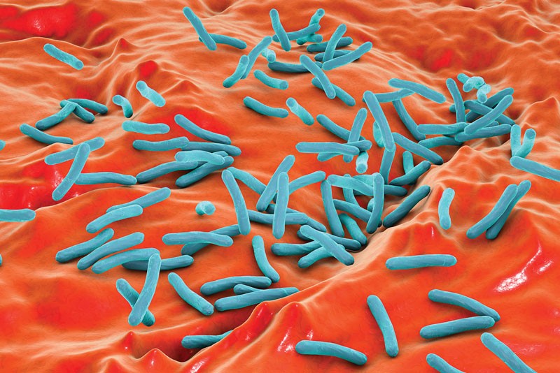 Ribosome inhibitor combats bacterial drug resistance