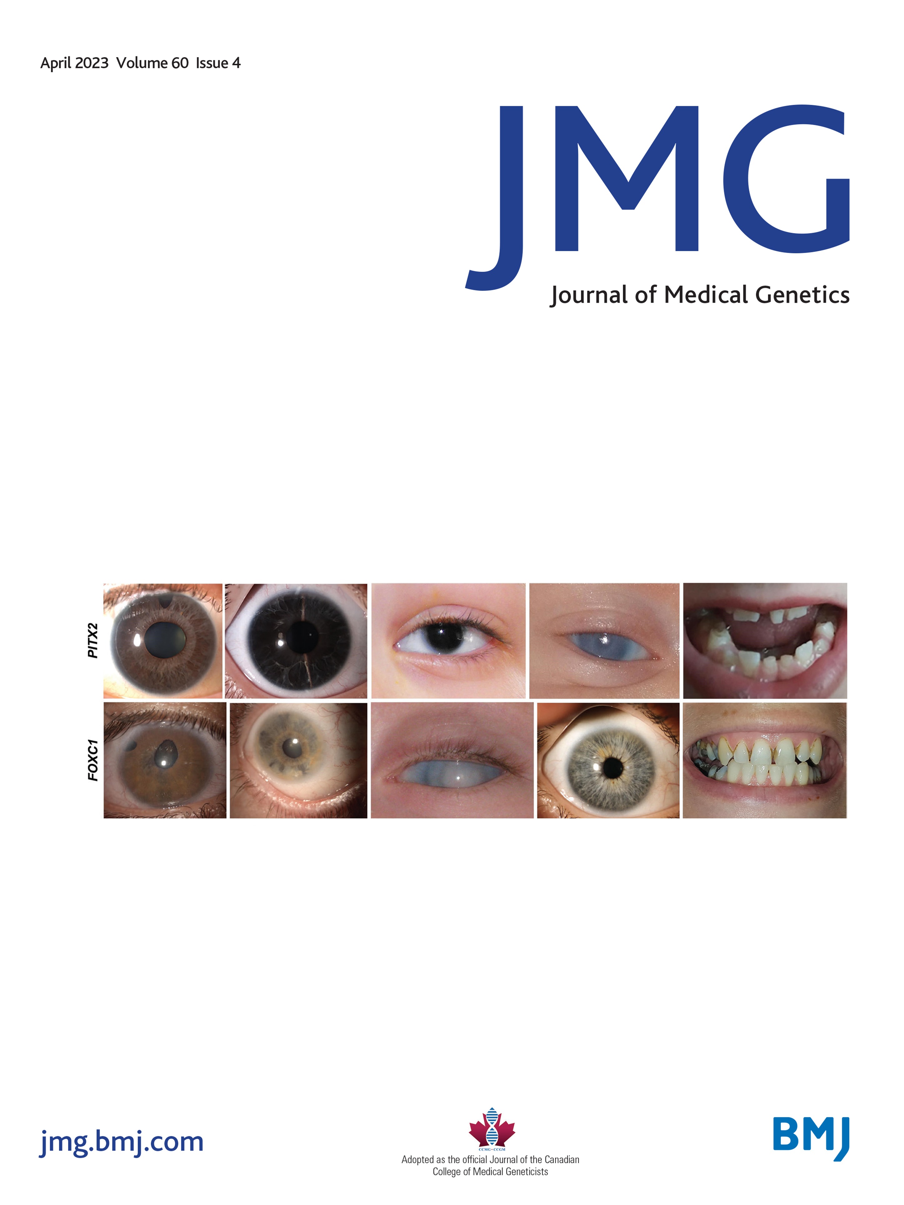 MRM2 variants in families with complex dystonic syndromes: evidence for phenotypic heterogeneity