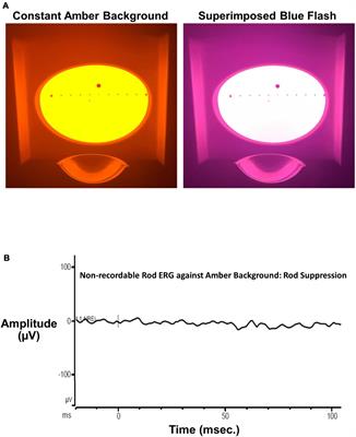 A new method to quantify the human visual threshold from melanopsin sensitive ganglion cells