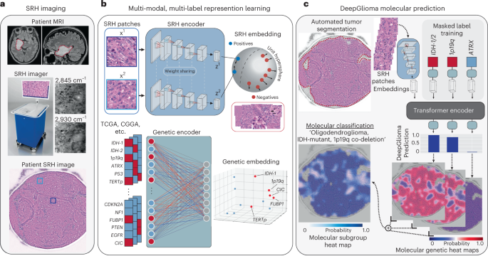 Artificial-intelligence-based molecular classification of diffuse gliomas using rapid, label-free optical imaging