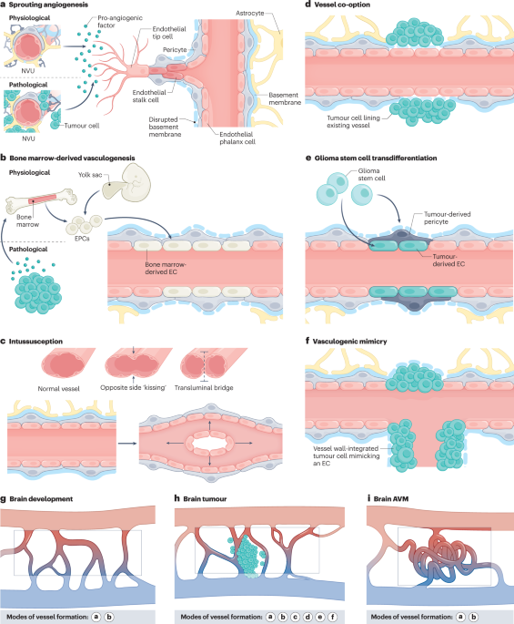 Shaping the brain vasculature in development and disease in the single-cell era