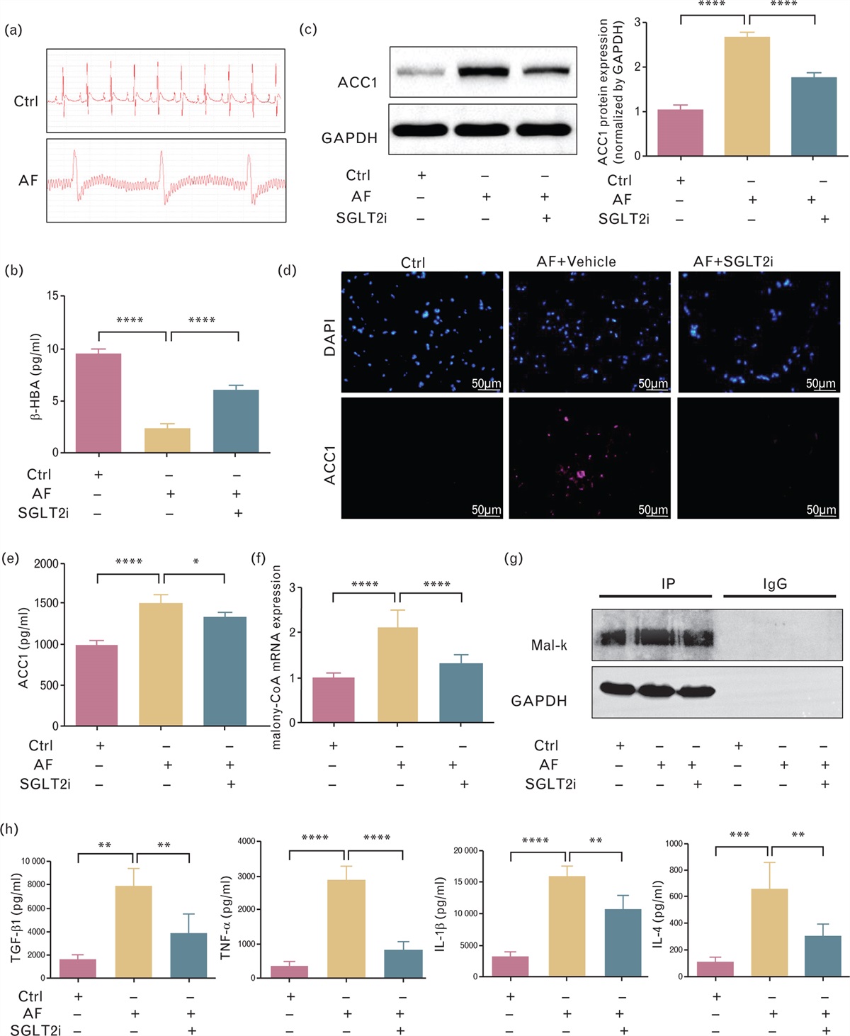 SGLT2i alleviates epicardial adipose tissue inflammation by modulating ketone body–glyceraldehyde-3-phosphate dehydrogenase malonylation pathway