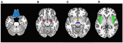 Corrigendum: Differential neural reward reactivity in response to food advertising medium in children