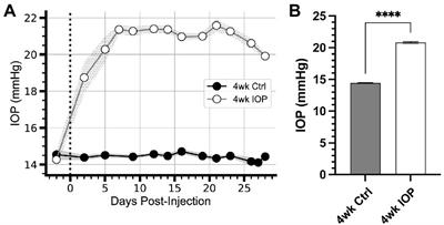 Retinal ganglion cells adapt to ionic stress in experimental glaucoma