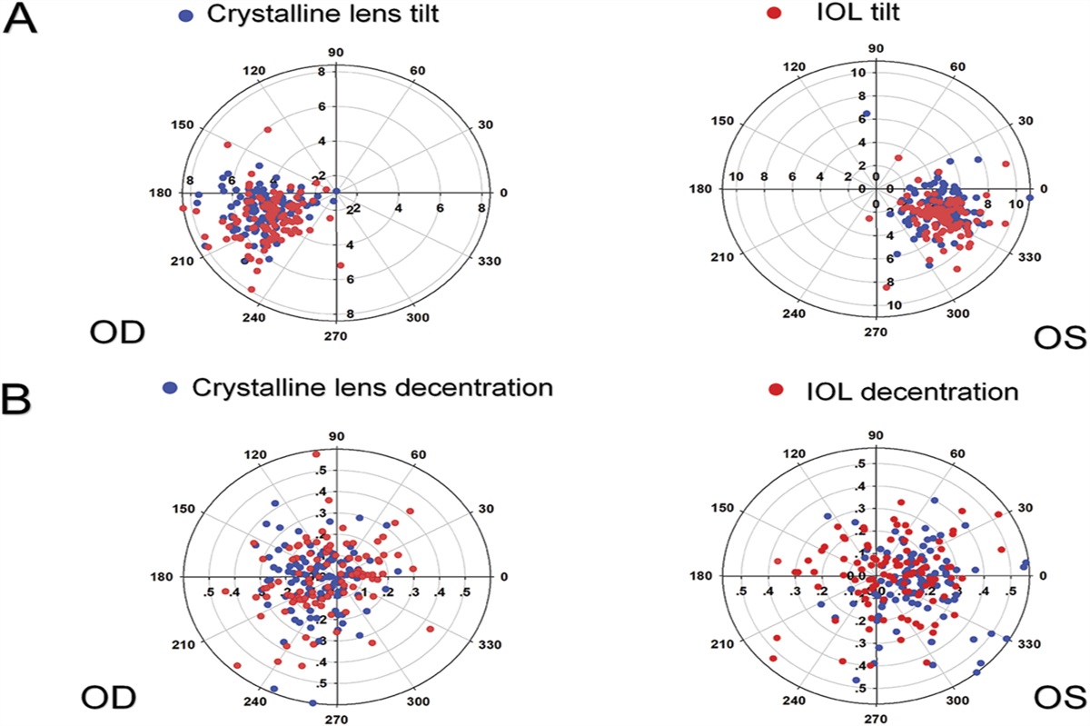 Building prediction models of clinically significant intraocular lens tilt and decentration for age-related cataract