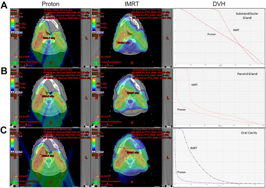 Advances in Proton Therapy for the Management of Head and Neck Tumors