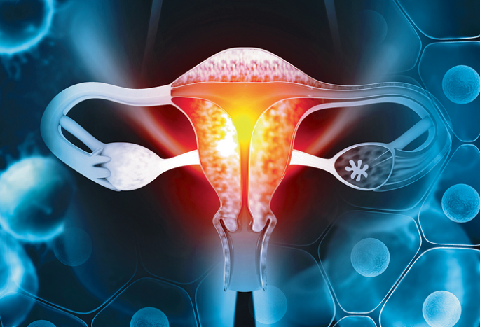 Adding immune-checkpoint inhibitors to chemotherapy extends survival in endometrial cancer