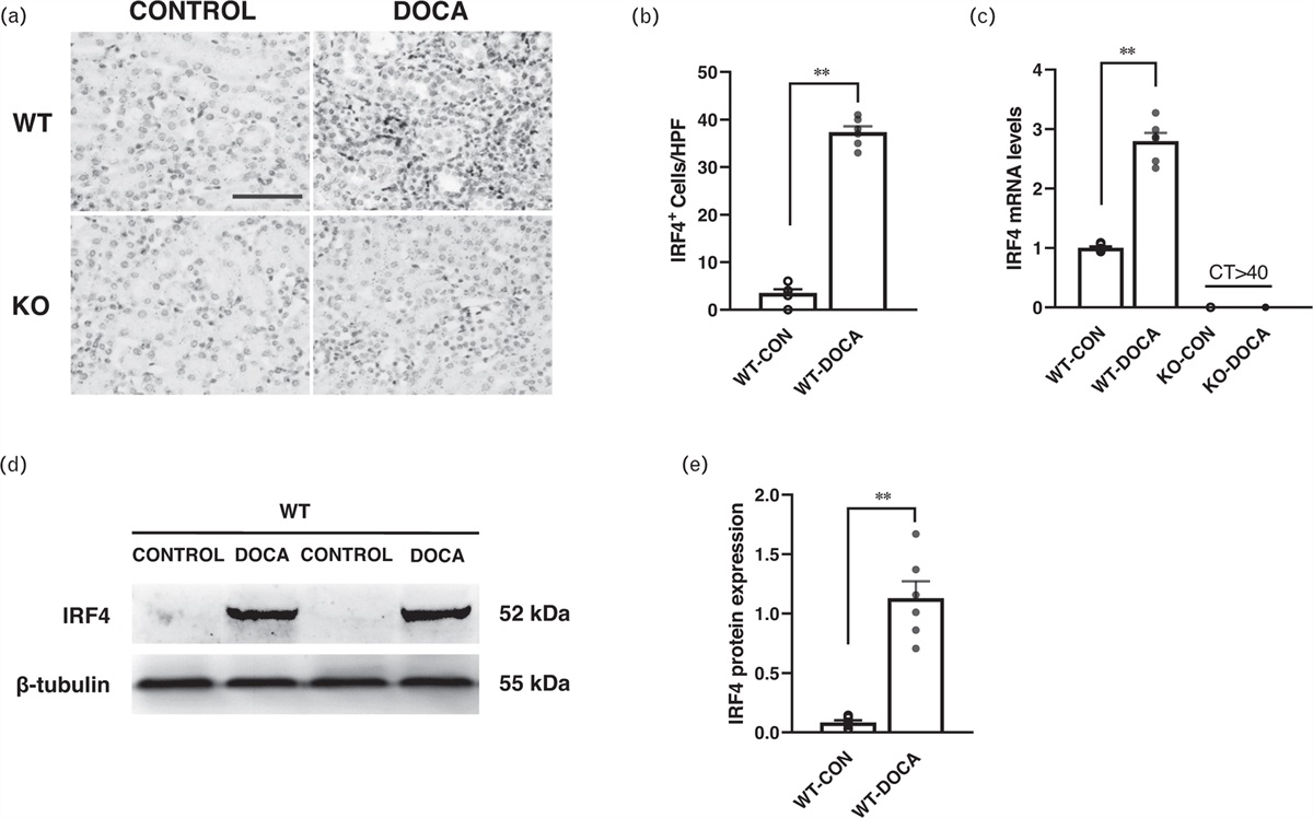 Interferon regulatory factor 4 deletion protects against kidney inflammation and fibrosis in deoxycorticosterone acetate/salt hypertension