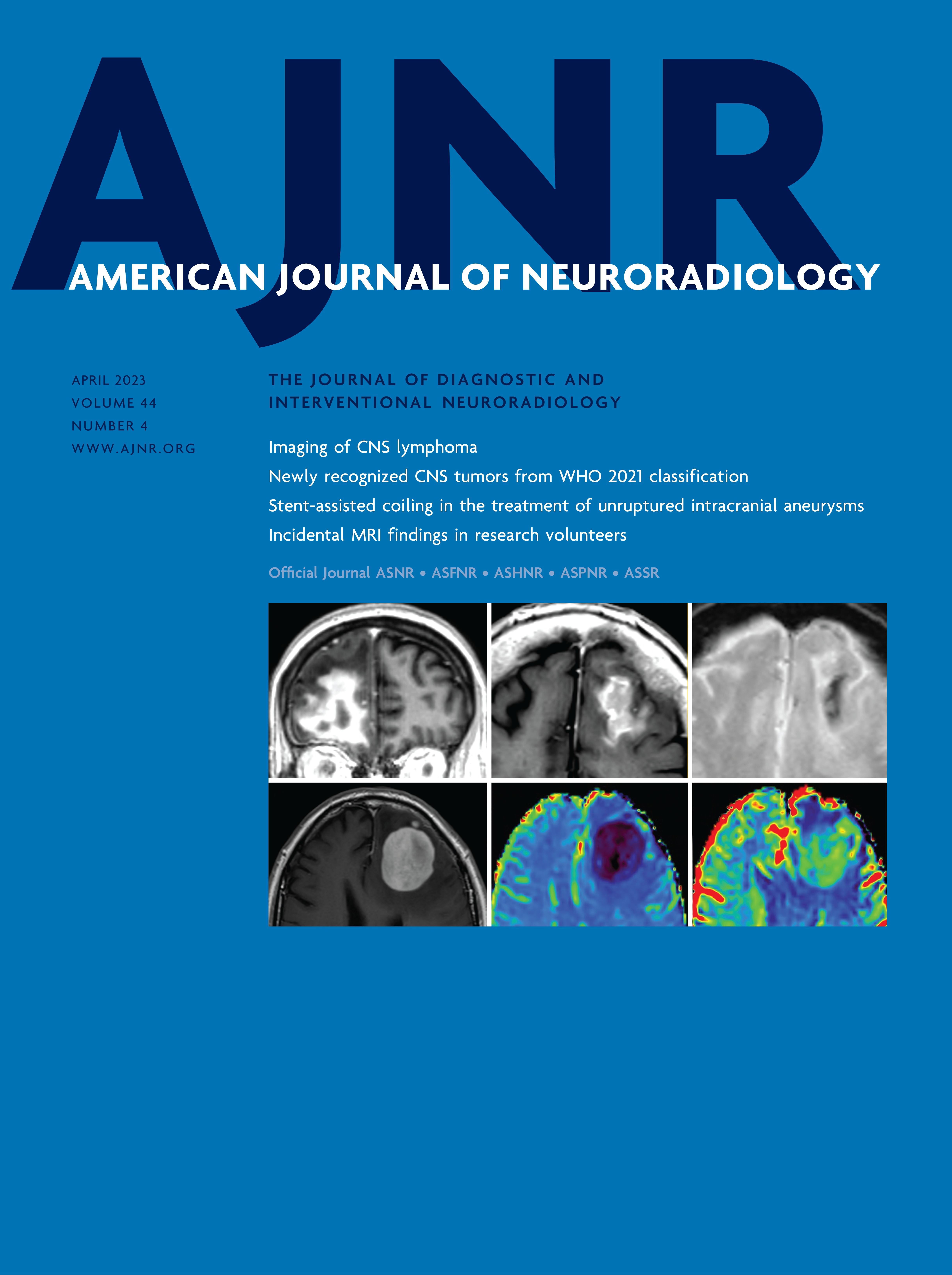 Newly Recognized CNS Tumors in the 2021 World Health Organization Classification: Imaging Overview with Histopathologic and Genetic Correlation [ADULT BRAIN]