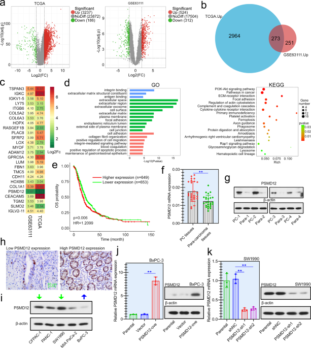 PSMD12 interacts with CDKN3 and facilitates pancreatic cancer progression