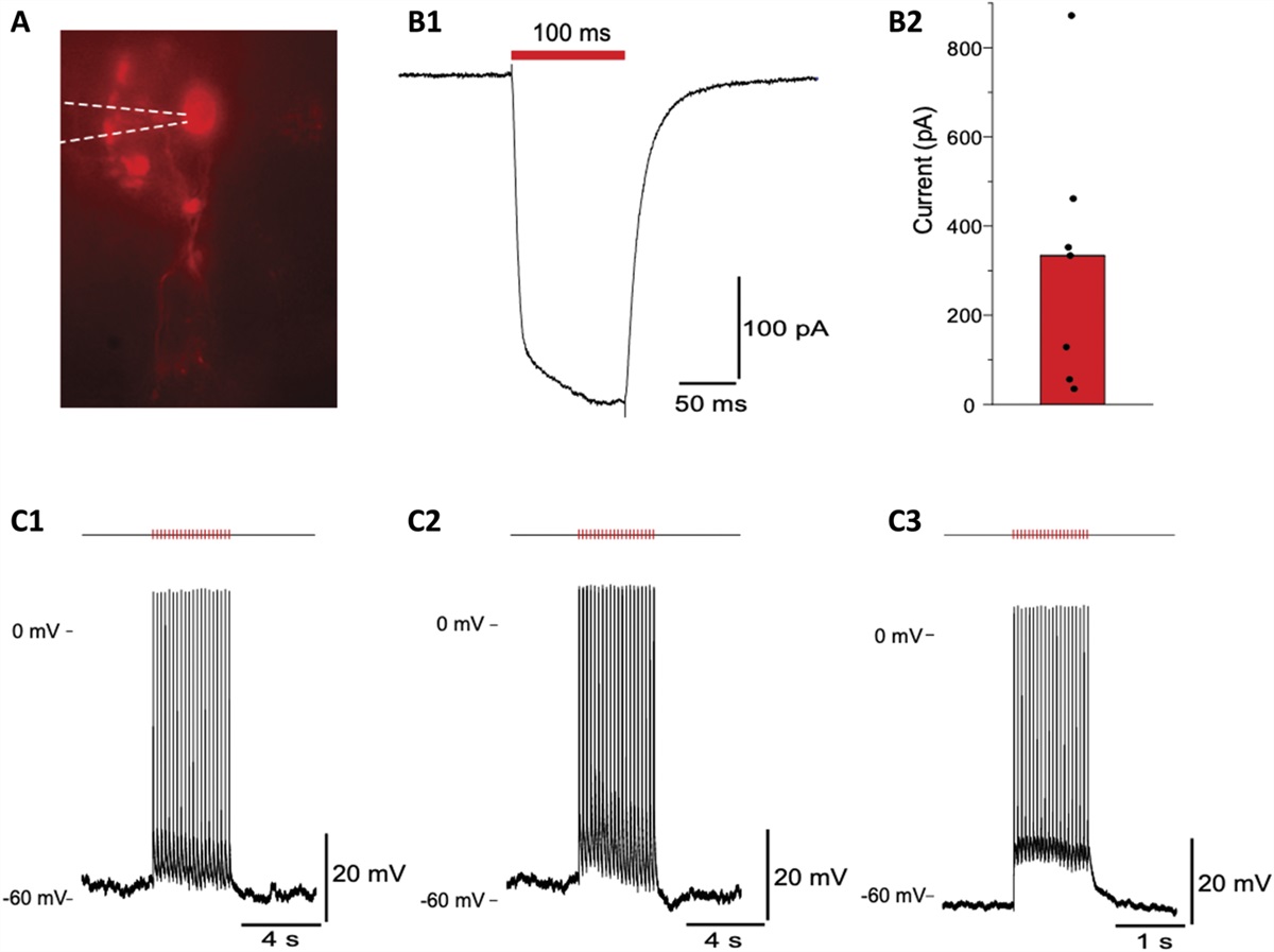 Pro-opiomelanocortin neurons in the nucleus of the solitary tract mediate endorphinergic endogenous analgesia in mice