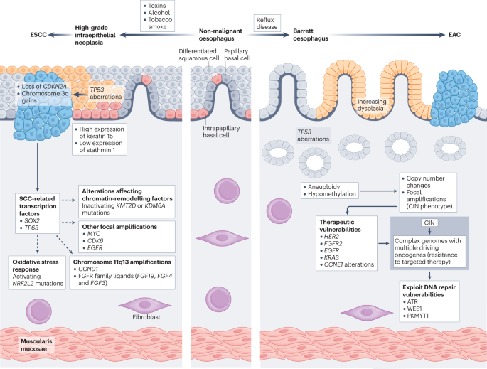 Improving outcomes in patients with oesophageal cancer