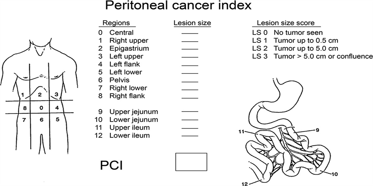 Secondary Cytoreductive Surgery With Hyperthermic Intraperitoneal Chemotherapy for Advanced or Recurrent Mucinous Ovarian Cancer