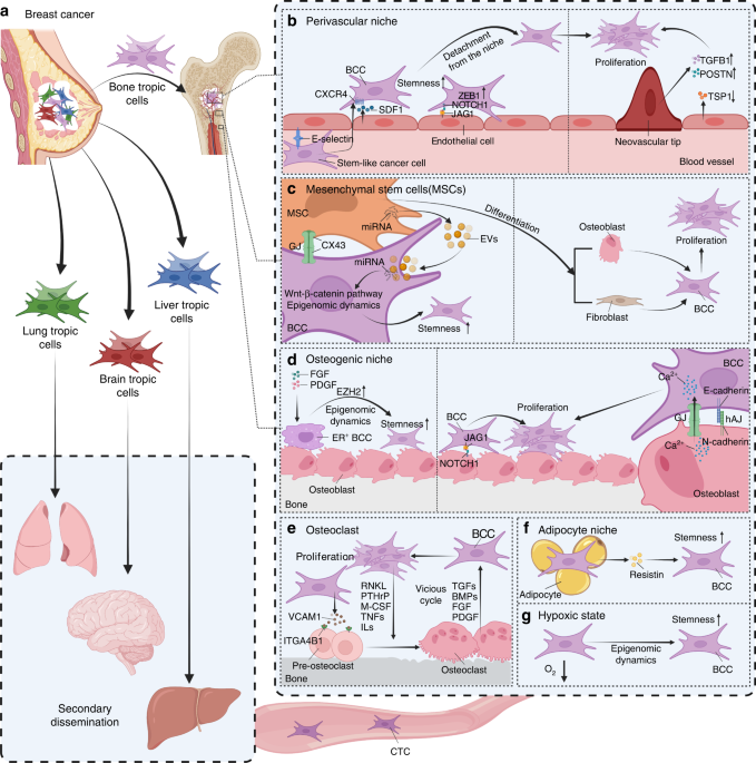 Bone serves as a transfer station for secondary dissemination of breast cancer