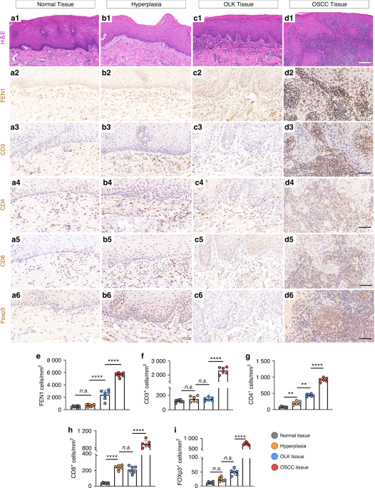 Down-regulation of DNA key protein-FEN1 inhibits OSCC growth by affecting immunosuppressive phenotypes via IFN-γ/JAK/STAT-1