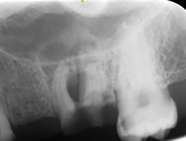 An investigation into oral surgery referrals in Wales