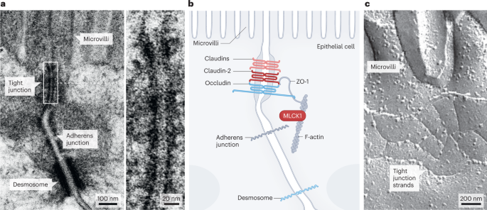 Paracellular permeability and tight junction regulation in gut health and disease