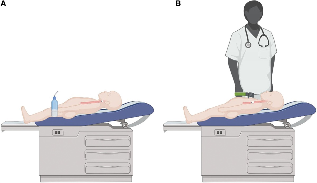 Magnetic-Assisted Capsule Endoscopy in Children With Crohn Disease: Feasibility and Impact on Gastric Transit Time