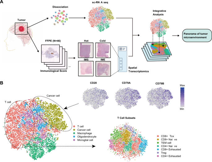 Spatial single cell analysis of tumor microenvironment remodeling pattern in primary central nervous system lymphoma