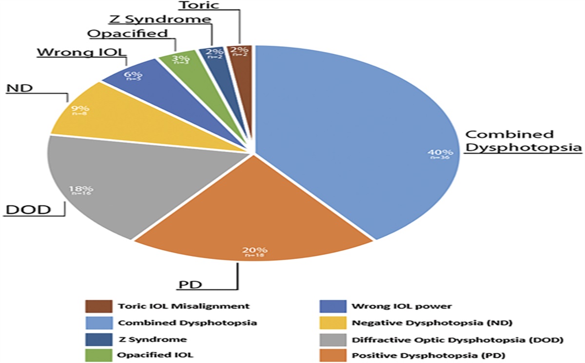 Clinical outcomes and complications following intraocular lens exchange in the setting of an open or intact posterior capsule