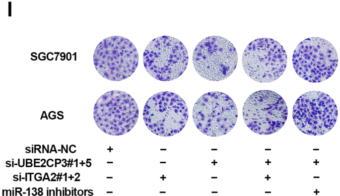 Correction: The ELF3-regulated lncRNA UBE2CP3 is over-stabilized by RNA–RNA interactions and drives gastric cancer metastasis via miR-138-5p/ITGA2 axis
