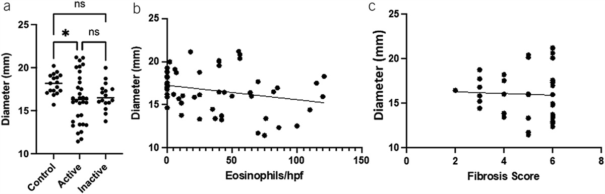 The Slender Esophagus: Unrecognized Esophageal Narrowing in Eosinophilic Esophagitis