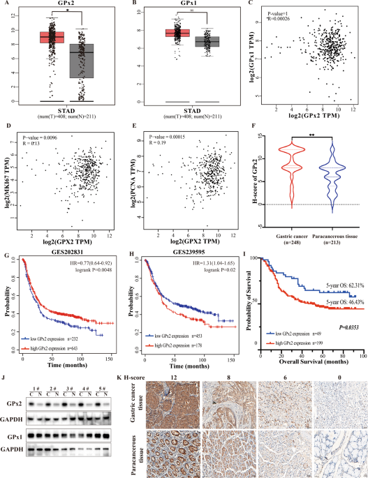 Glutathione peroxidase 2 knockdown suppresses gastric cancer progression and metastasis via regulation of kynurenine metabolism