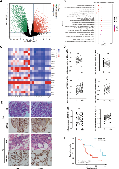 Peritoneal high-fat environment promotes peritoneal metastasis of gastric cancer cells through activation of NSUN2-mediated ORAI2 m5C modification
