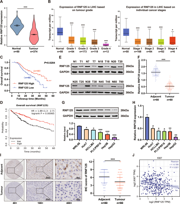 RNF125 attenuates hepatocellular carcinoma progression by downregulating SRSF1-ERK pathway