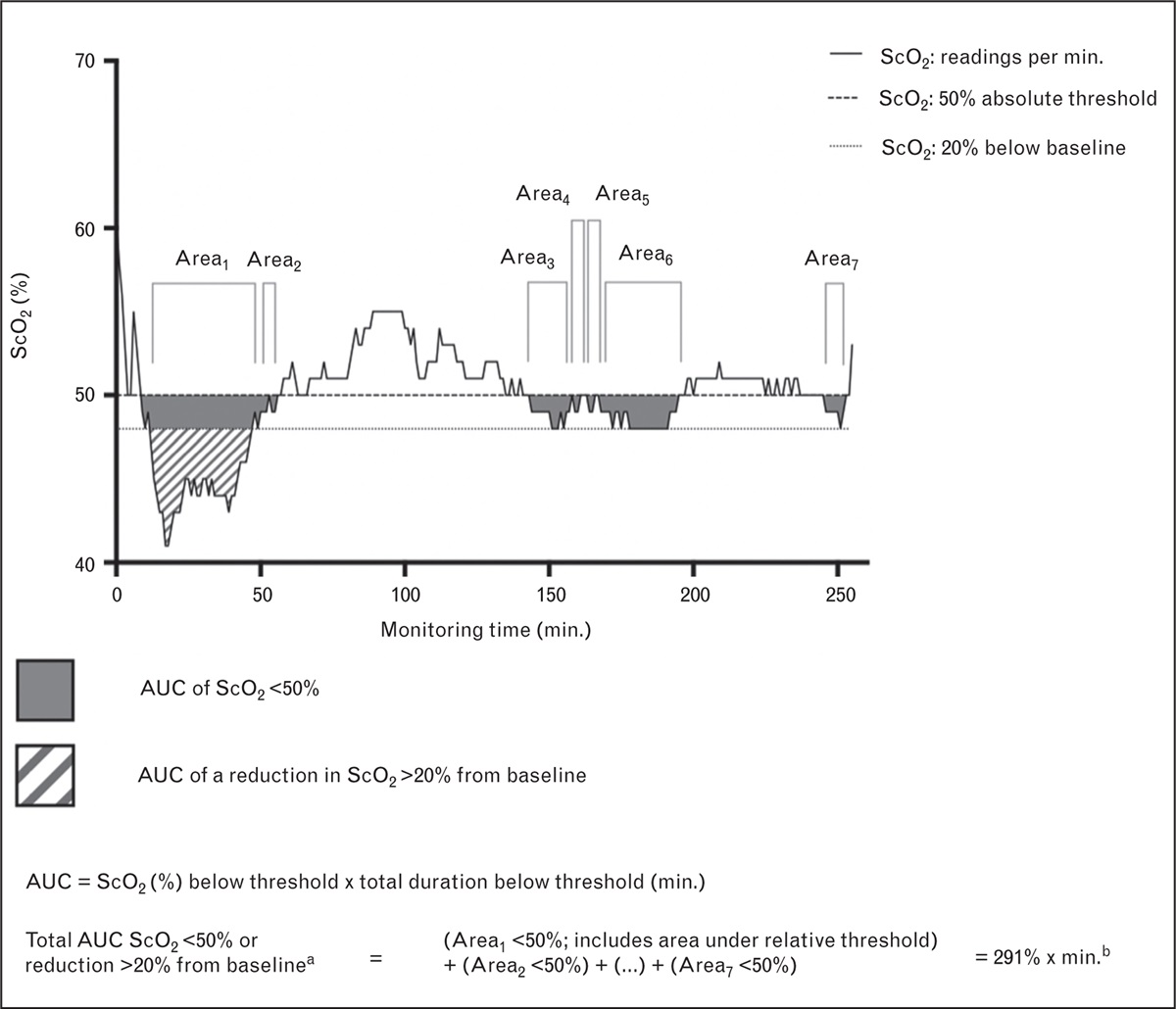 Near-infrared spectroscopy and processed electroencephalogram monitoring for predicting peri-operative stroke risk in cardiothoracic surgery: An observational cohort study