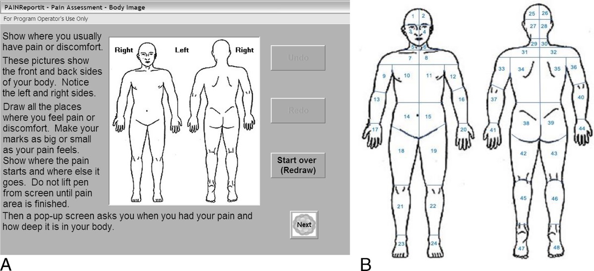 Quantification of Patient-Reported Pain Locations: Development of an Automated Measurement Method