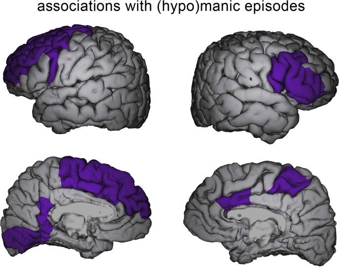 Mania-related effects on structural brain changes in bipolar disorder – a narrative review of the evidence